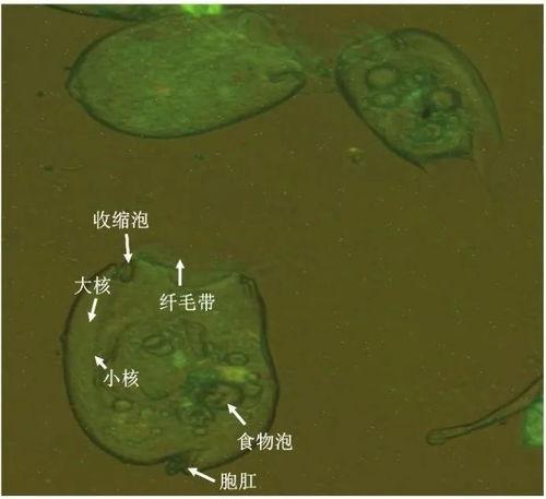 生物原虫在线视频,在线视频揭秘寄生虫奥秘